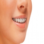 Top Private Dentists in Westwood 8