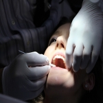 Dental Implants Prices in Harwell 9