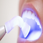 Top Private Dentists in Weston 7