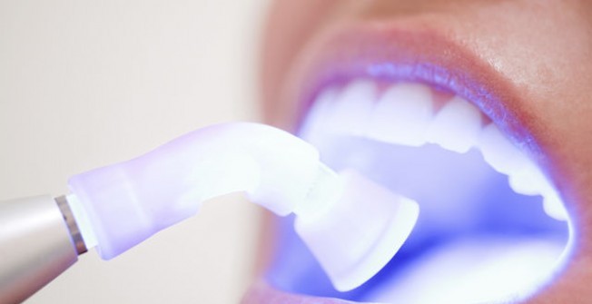Laser Teeth Whitening in Adisham